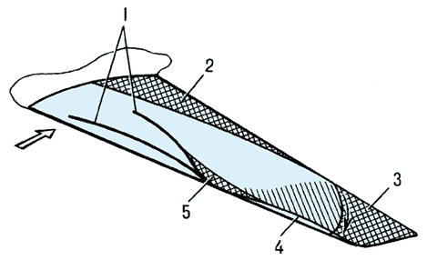 Зоны отрыва потока на крыле при трансзвуковой скорости:1 — скачки уплотнения;2 — отрыв на задней кромке;3 — отрыв на конце крыла;4 — отрыв с передней кромки;5 — отрыв, индуцированный скачком;стрелка — направление потока.