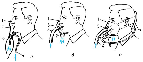 Кислородные маски:а — полузакрытая;б — закрытая;в — с избыточным давлением;1 — полость маски;2 — клапан выдоха;3 — дыхательный мешок;4 — шланг подачи кислорода;5 — клапан вдоха;6 — компенсированный клапан выдоха;7 — компенсатор натяга.
